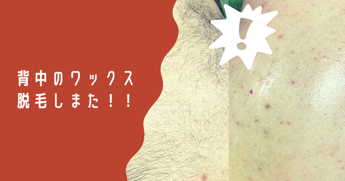 実は気になる背中の産毛や体毛も綺麗に脱毛 背中ワックス脱毛施術致しました うるま市で髭 ヒゲ 脱毛ならメンズ脱毛サロン So What 金武町屋嘉店