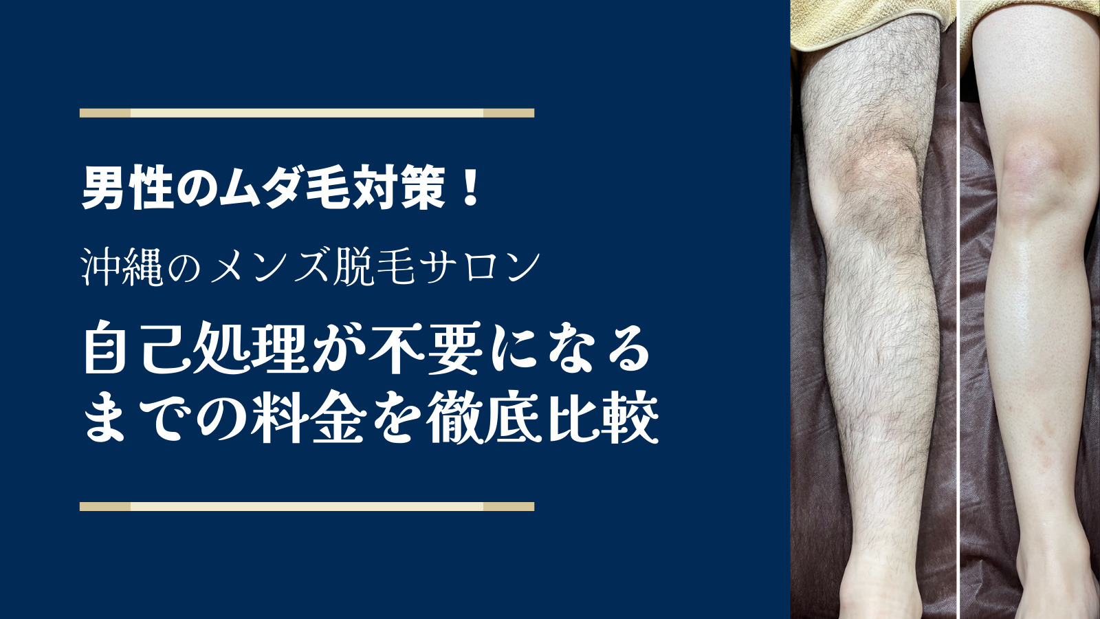 沖縄メンズ脱毛 ひげ脱毛を安い料金でサロン別に徹底比較 沖縄うるま市近くのメンズ脱毛サロンはひげ脱毛 Vio 全身可能 So What